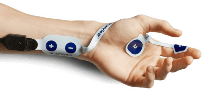 Arm with TwitchView electromyography (EMG) electrode array