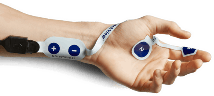 Arm with TwitchView electromyography (EMG) electrode array Arm with TwitchView electromyography (EMG) electrode array
