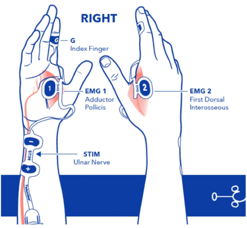 Andrew Bowdle - 10.12.25 - Fig. 4