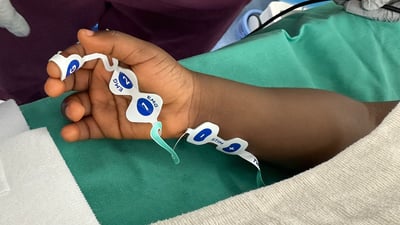 train of four hand monitoring sites