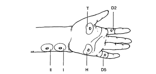 Bowdle Fig 1 12.17.25