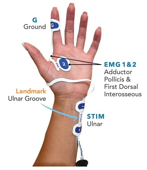 Lectroids Hand TwitchView User Guide