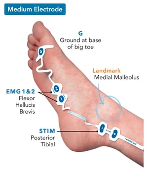 ElectrodePlacement_Medium_v2b_foot