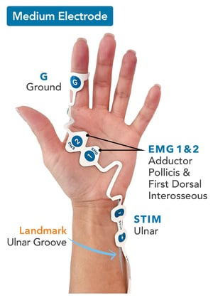 ElectrodePlacement_Medium_v2b_hand