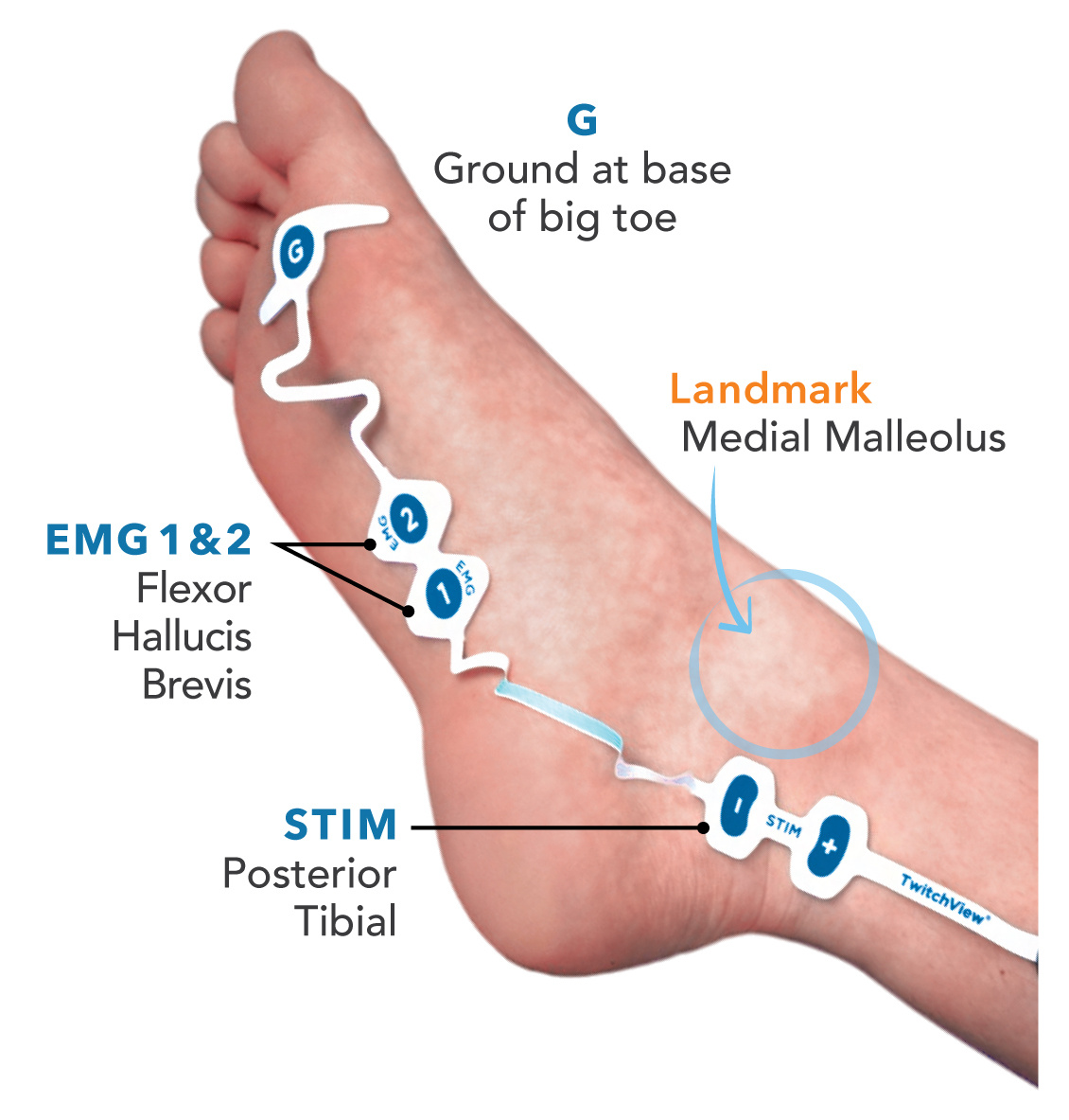 ElectrodePlacement_Medium_v2c_foot