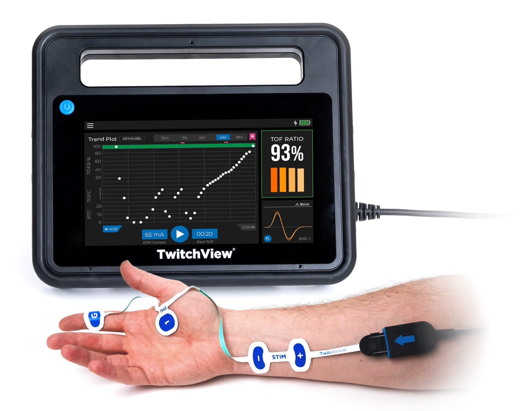 TwitchView Train of Four Monitor with Electrode