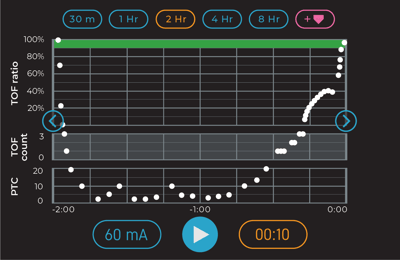 TwitchView TOF Monitor Trend with new provider