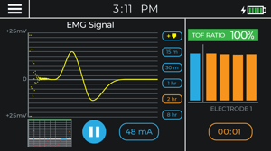 TwitchView EMG TOFR 100%