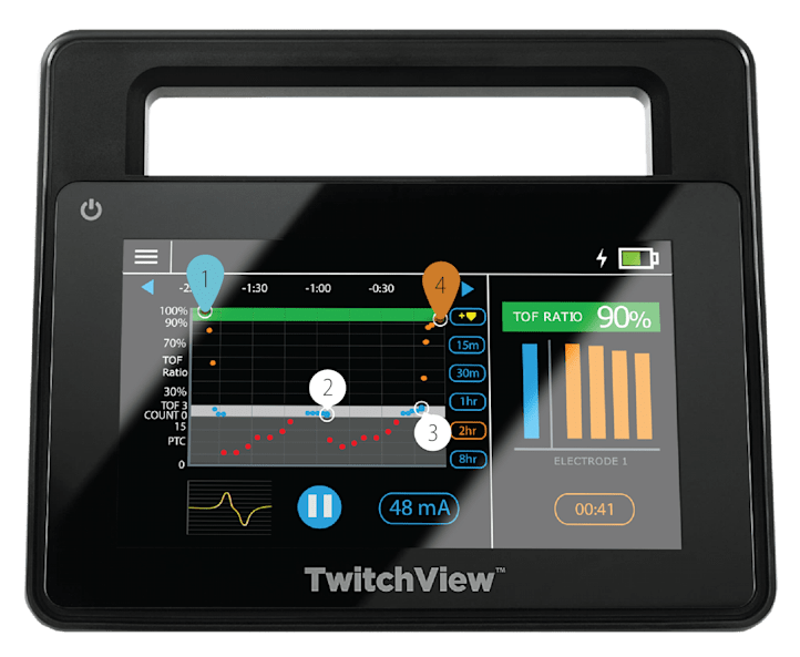 TwitchView - quantitative neuromuscular monitoring device