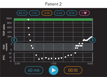 TwitchView TOF Monitor Trend displaying recovery from rocuronium. patient 2.