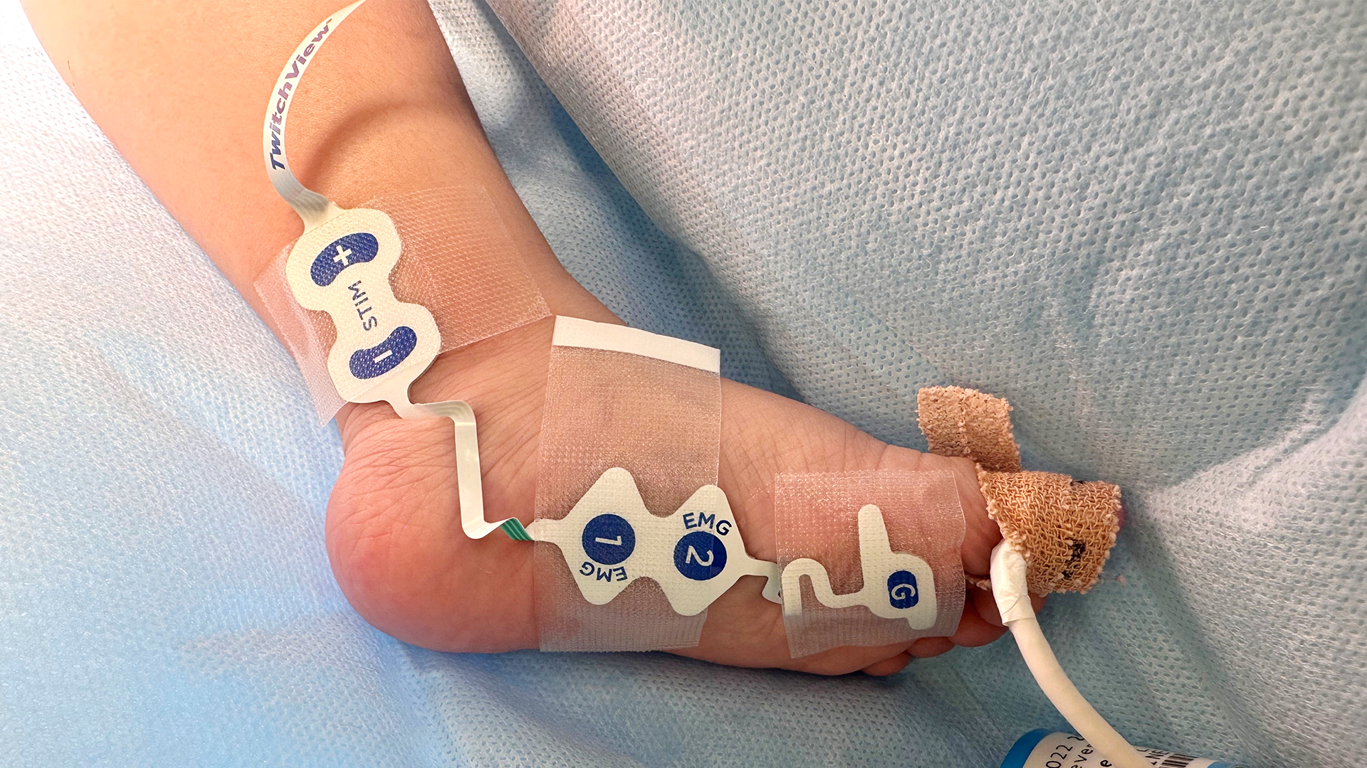 Small Patients, Big Changes: The First-Ever Pediatric Neuromuscular Block Guidelines Are Here