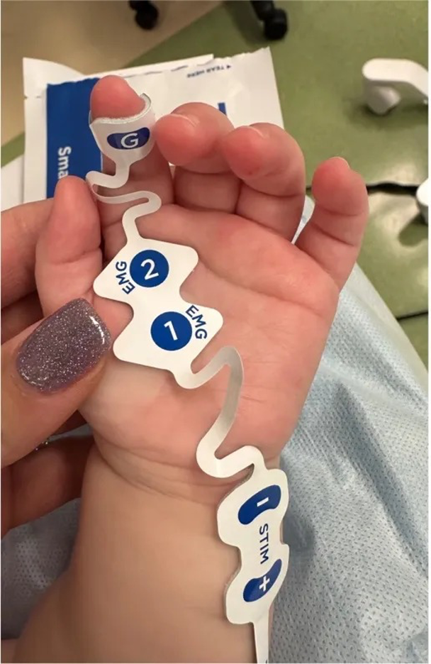 train of four hand monitoring sites