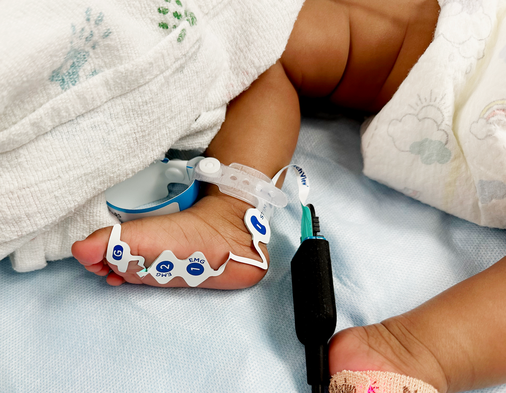 Can Residual Neuromuscular Blockade (RNMB) Cause Post-Operative Critical Respiratory Events in Pediatric Patients?