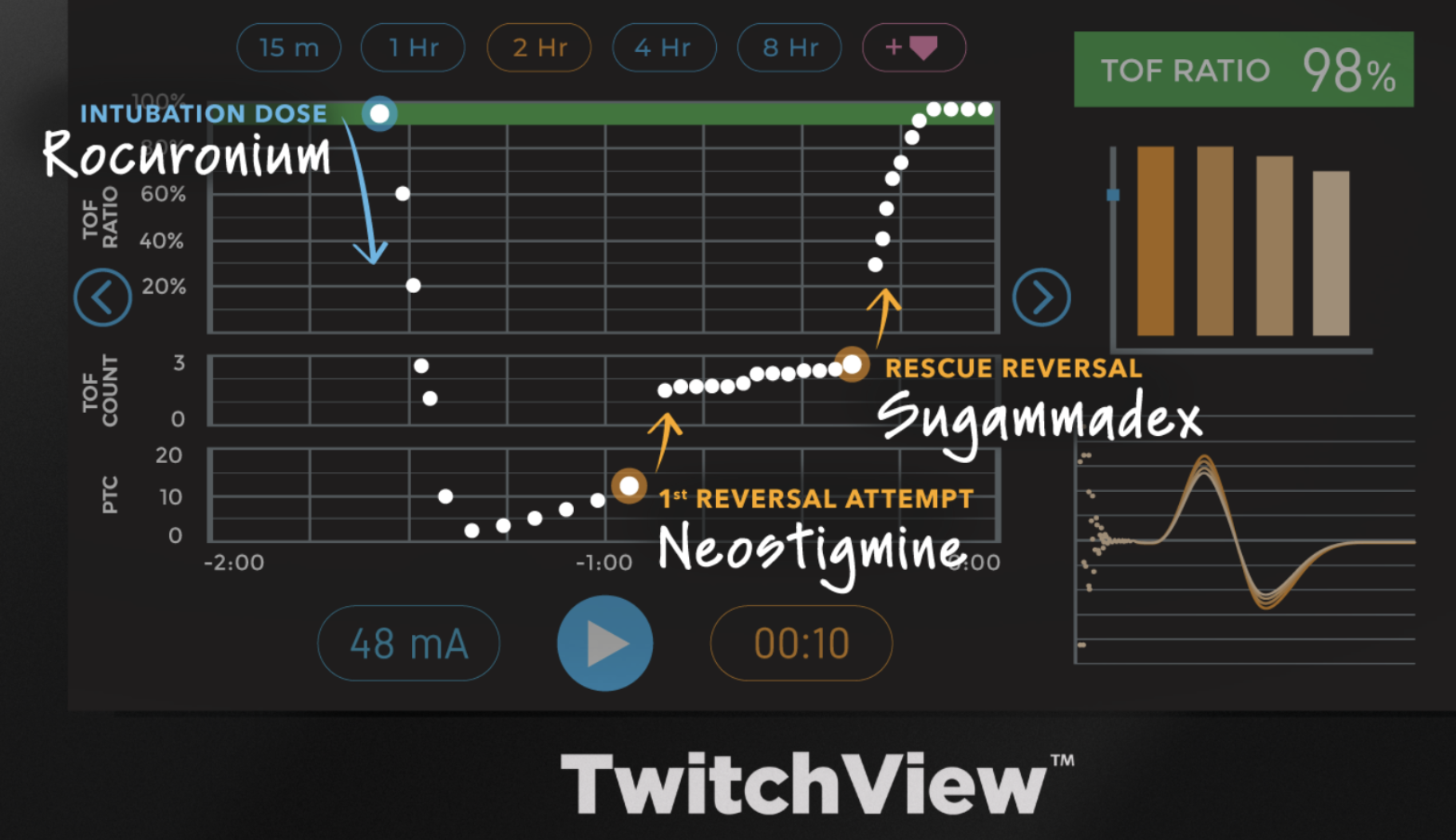 Twitchview train-of-four monitor trend plot with neostigmine and sugammadex reversal