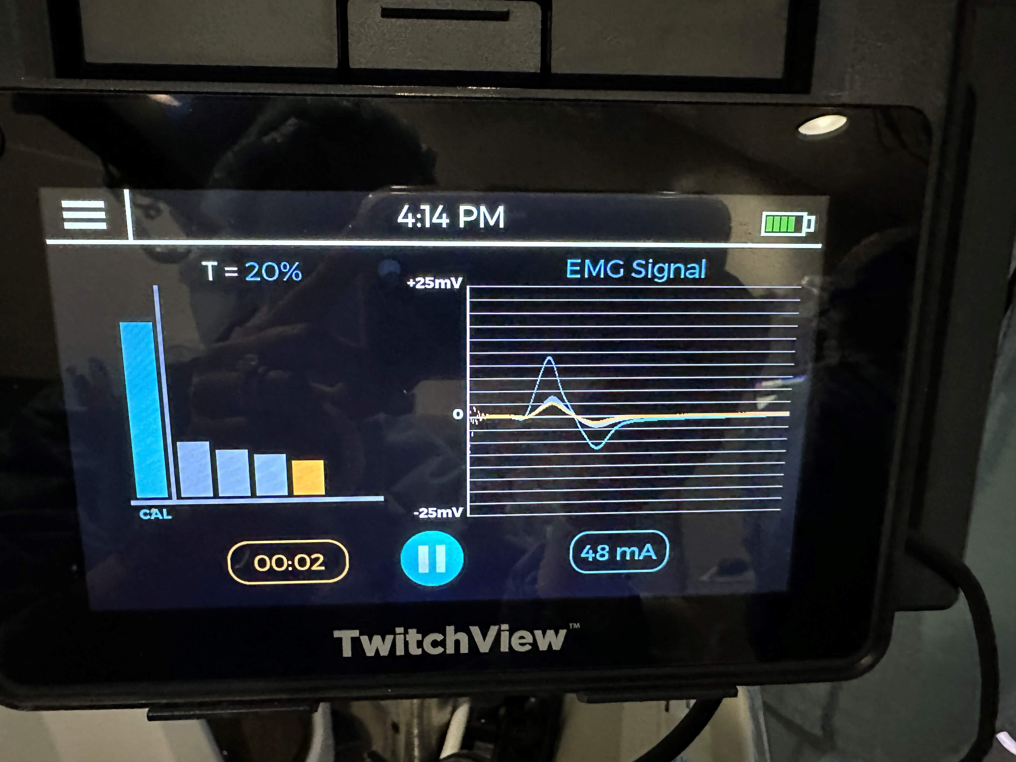 TwitchView Single Twitch Monitoring Mode T=20%