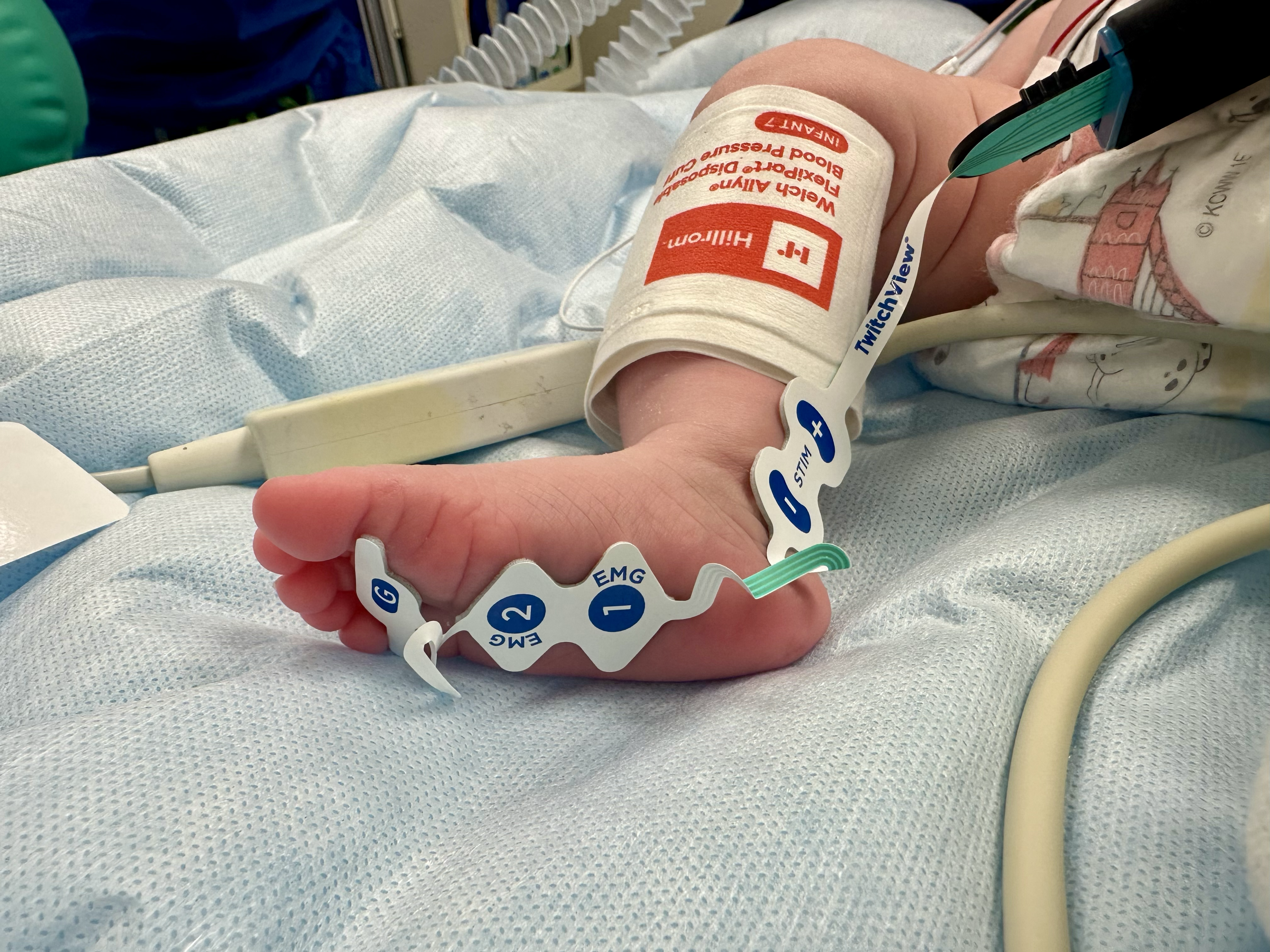Rethinking Neuromuscular Blockade in Pediatric Intubation: What the Latest Evidence Tells Us